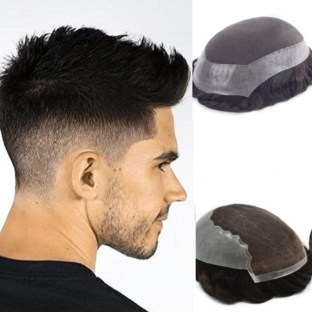 The Best Hair Replacement Centre in the UAE