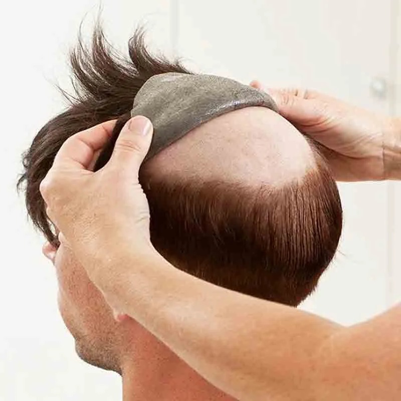 non surgical hair replacement