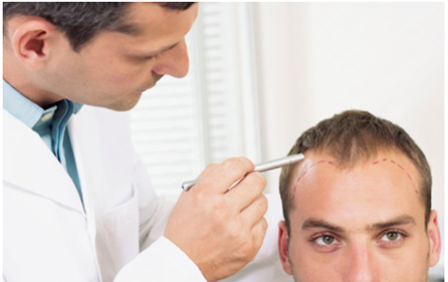 non surgical hair replacement hair replacement